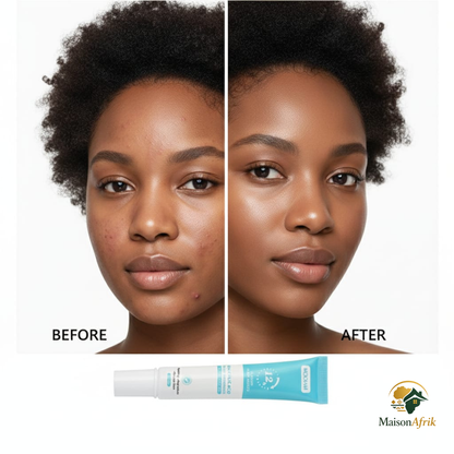 PeauNette Gel™ 1 acheté = 1 offerte 🎁