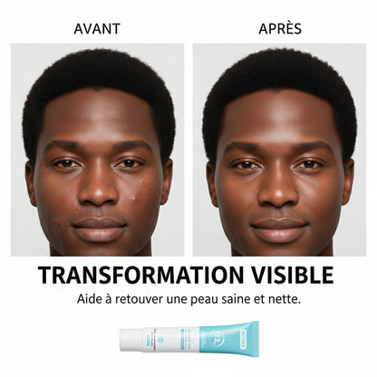 PeauNette Gel™ 1 acheté = 1 offerte 🎁